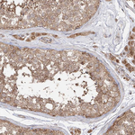 AIM2 Antibody in Immunohistochemistry (Paraffin) (IHC (P))