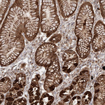 AIM2 Antibody in Immunohistochemistry (Paraffin) (IHC (P))