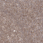 AIM2 Antibody in Immunohistochemistry (Paraffin) (IHC (P))
