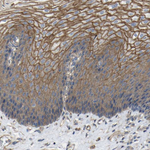 TL1A Antibody in Immunohistochemistry (Paraffin) (IHC (P))