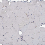 uPAR Antibody in Immunohistochemistry (Paraffin) (IHC (P))