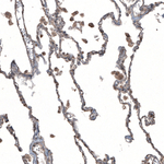uPAR Antibody in Immunohistochemistry (Paraffin) (IHC (P))