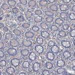 uPAR Antibody in Immunohistochemistry (Paraffin) (IHC (P))