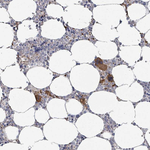 uPAR Polyclonal Antibody