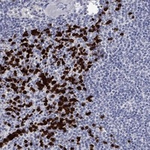 IRF5 Antibody in Immunohistochemistry (Paraffin) (IHC (P))