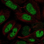 NFYB Antibody in Immunocytochemistry (ICC/IF)