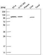 ADAMTS9 Antibody in Western Blot (WB)