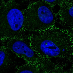 beta-1,2 Adaptin Polyclonal Antibody