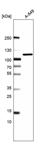 beta-1,2 Adaptin Antibody in Western Blot (WB)