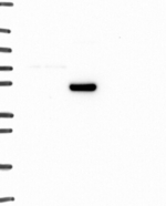 alpha-1a Adrenergic Receptor Antibody in Western Blot (WB)