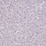 PAR6 Antibody in Immunohistochemistry (Paraffin) (IHC (P))