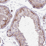 PAR6 Antibody in Immunohistochemistry (Paraffin) (IHC (P))