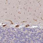 PAR6 Antibody in Immunohistochemistry (Paraffin) (IHC (P))