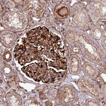 PAR6 Antibody in Immunohistochemistry (Paraffin) (IHC (P))