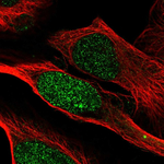 PSME2 Polyclonal Antibody