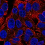 WDFY2 Polyclonal Antibody