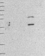 WDFY2 Antibody in Western Blot (WB)