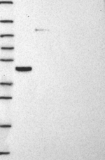 STARD3 Antibody in Western Blot (WB)