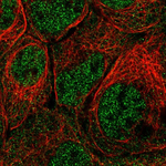 PRMT2 Polyclonal Antibody