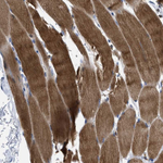 PRMT2 Antibody in Immunohistochemistry (Paraffin) (IHC (P))