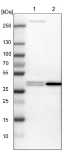 PRMT2 Antibody in Western Blot (WB)