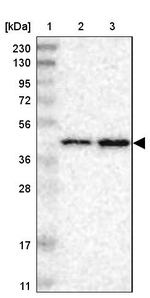 PRMT2 Antibody in Western Blot (WB)