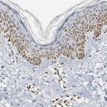 AMPK gamma-2 Antibody in Immunohistochemistry (Paraffin) (IHC (P))