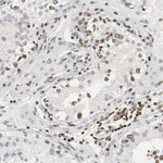AMPK gamma-2 Antibody in Immunohistochemistry (Paraffin) (IHC (P))
