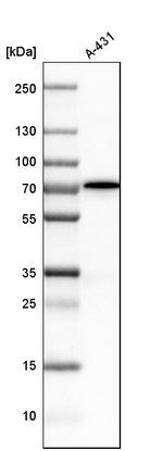 AMPK gamma-2 Antibody in Western Blot (WB)