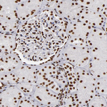 MRE11 Antibody in Immunohistochemistry (Paraffin) (IHC (P))