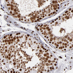 MRE11 Antibody in Immunohistochemistry (Paraffin) (IHC (P))