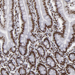 MRE11 Antibody in Immunohistochemistry (Paraffin) (IHC (P))
