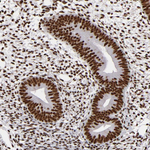 MRE11 Antibody in Immunohistochemistry (Paraffin) (IHC (P))