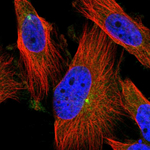 PCYT2 Polyclonal Antibody