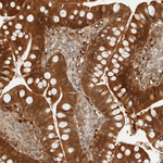 PCYT2 Antibody in Immunohistochemistry (Paraffin) (IHC (P))