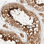 PCYT2 Antibody in Immunohistochemistry (Paraffin) (IHC (P))