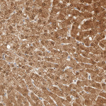 PCYT2 Antibody in Immunohistochemistry (Paraffin) (IHC (P))