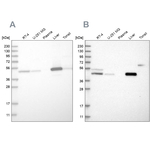 PCYT2 Antibody in Western Blot (WB)