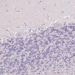 HSPA1A Antibody in Immunohistochemistry (Paraffin) (IHC (P))