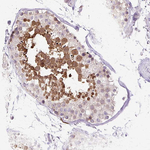 HSPA1A Antibody in Immunohistochemistry (Paraffin) (IHC (P))