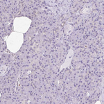 HSPA1A Antibody in Immunohistochemistry (Paraffin) (IHC (P))