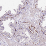 HSPA1A Antibody in Immunohistochemistry (Paraffin) (IHC (P))
