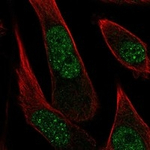 PPP2R3B Antibody in Immunocytochemistry (ICC/IF)