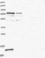 PPP2R3B Antibody in Western Blot (WB)