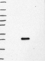 LMO2 Antibody in Western Blot (WB)