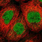 SENP1 Antibody in Immunocytochemistry (ICC/IF)
