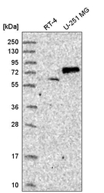 SENP1 Antibody in Western Blot (WB)