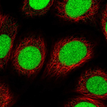 XPC Polyclonal Antibody