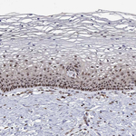 XPC Antibody in Immunohistochemistry (Paraffin) (IHC (P))