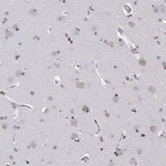 XPC Antibody in Immunohistochemistry (Paraffin) (IHC (P))